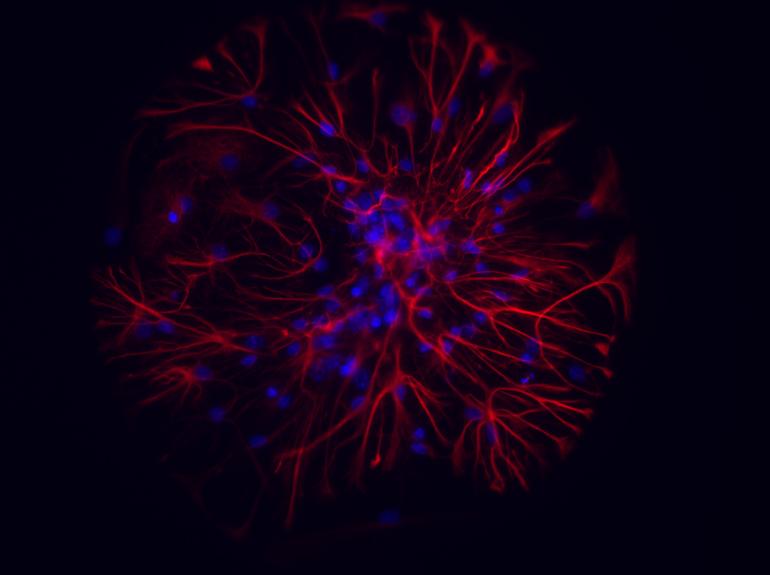 Neuroni e astrociti colorati al microscopio ottico a fluorescenza