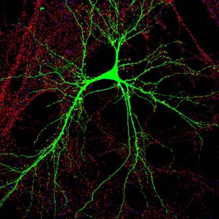 neurone eccitatorio