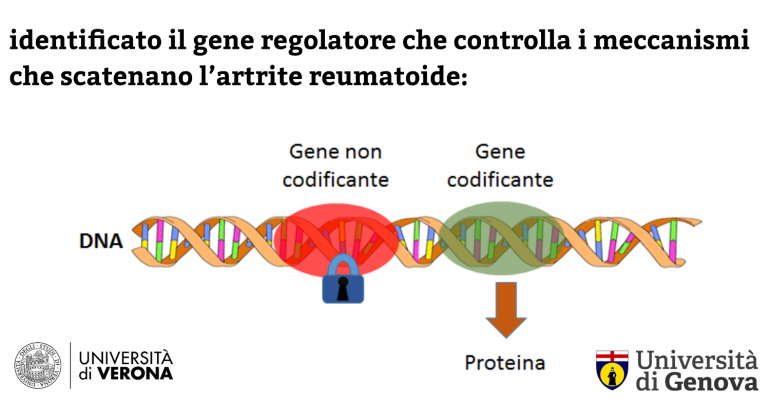 Gene identificato artrite reumatoide - UniGe