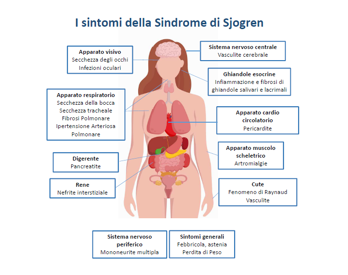Sintomi della Sindrome di Sjongren - UniGe