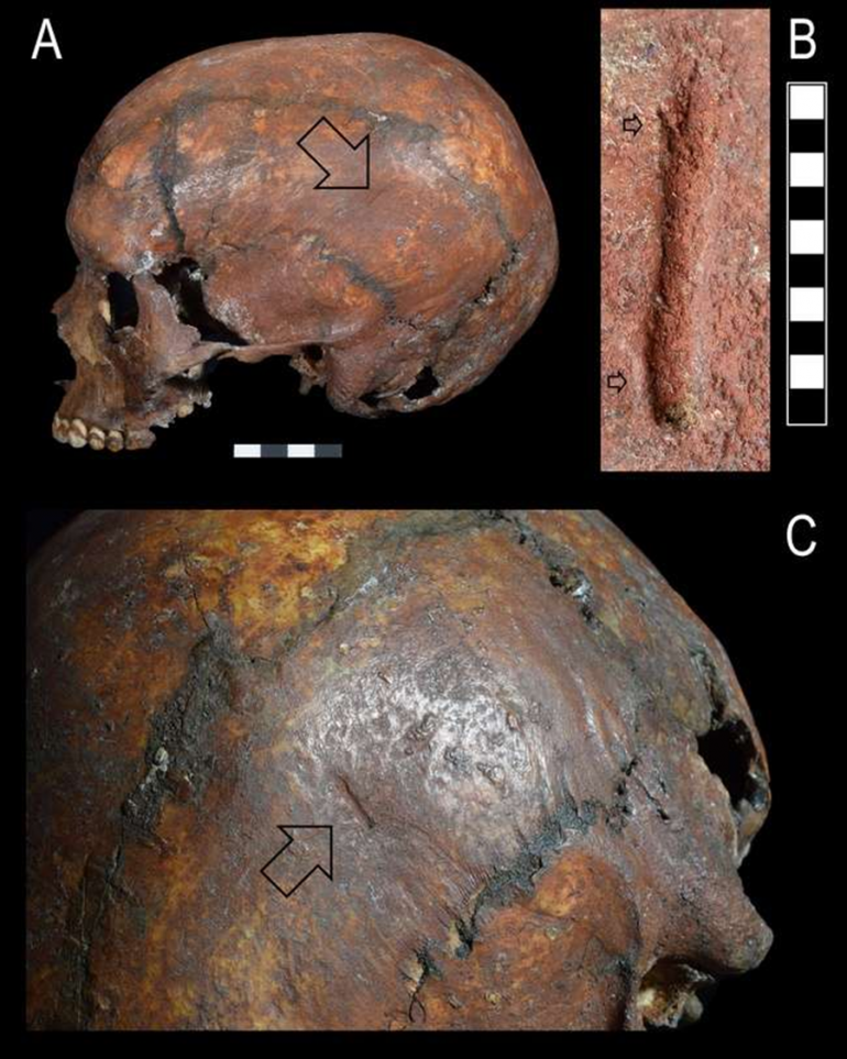 Nuove scoperte sui traumi scheletrici del Principe della Caverna delle Arene Candide
