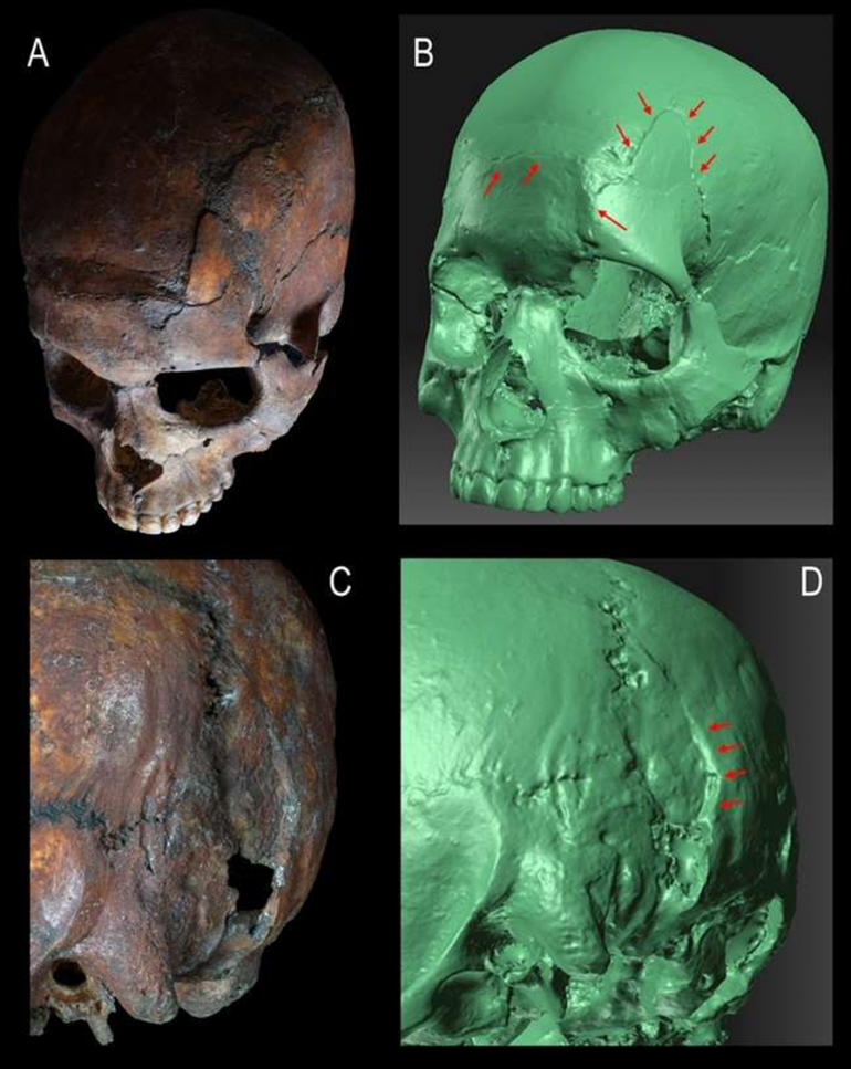 Nuove scoperte sui traumi scheletrici del Principe della Caverna delle Arene Candide