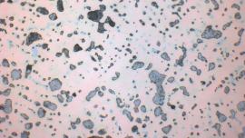 micrografia di un bronzo